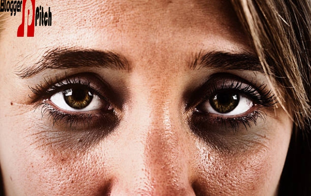 How To Avoid Depression Dark Circles Eye: The Truth About Eye Creams, Concealer, And More Depression Dark Circles Eye